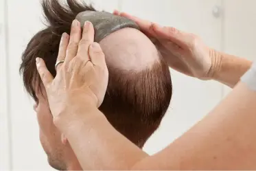 Best Hair Wig, Hair Patch in Chhattisgarh - Mahaveer Hair Solution